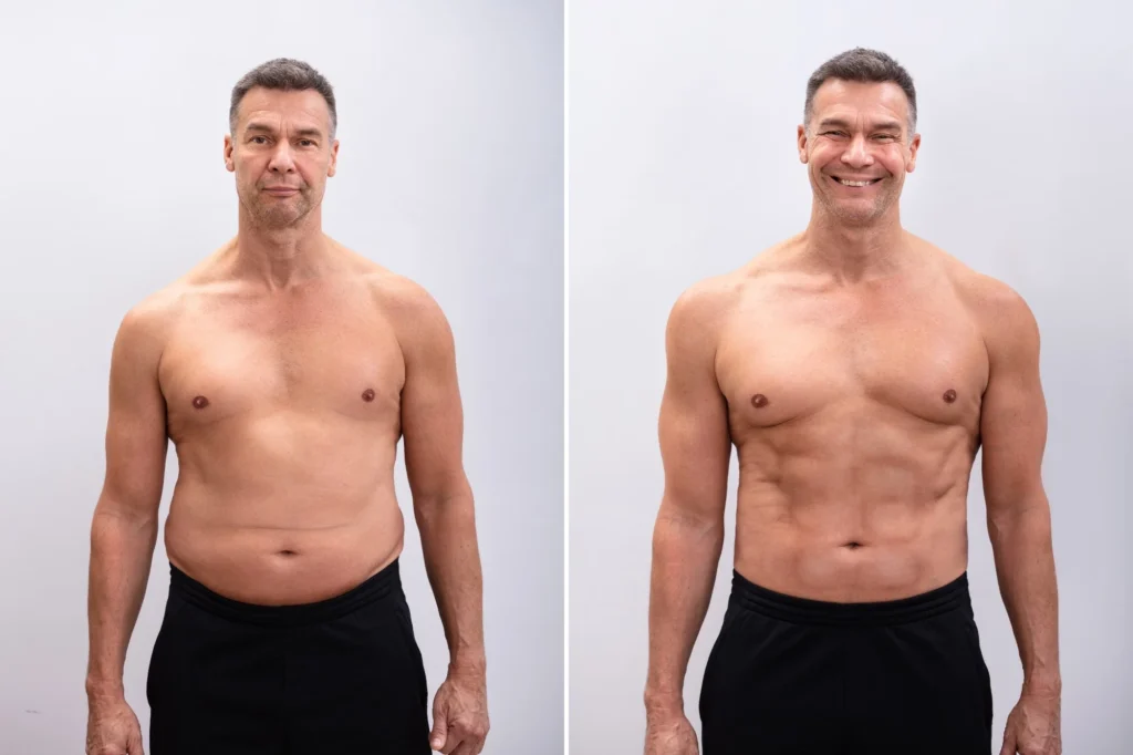 Do Fat Cells Disappear After Weight Loss?