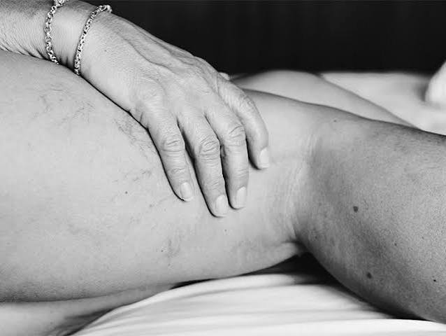 Can Diarrhea Cause Muscle Loss?